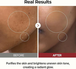 White Rice Ampoule - Peel Shot Exfoliant