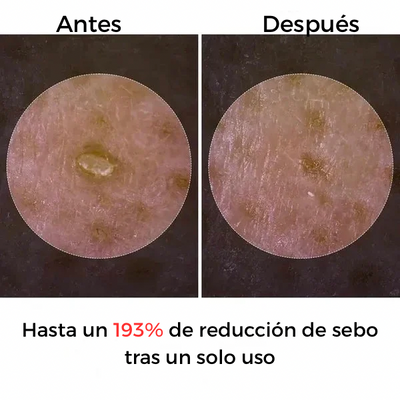 Exfoliante Peel Shot- Arroz Blanco y Arroz Negro