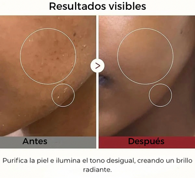 Exfoliante Peel Shot- Arroz Blanco y Arroz Negro