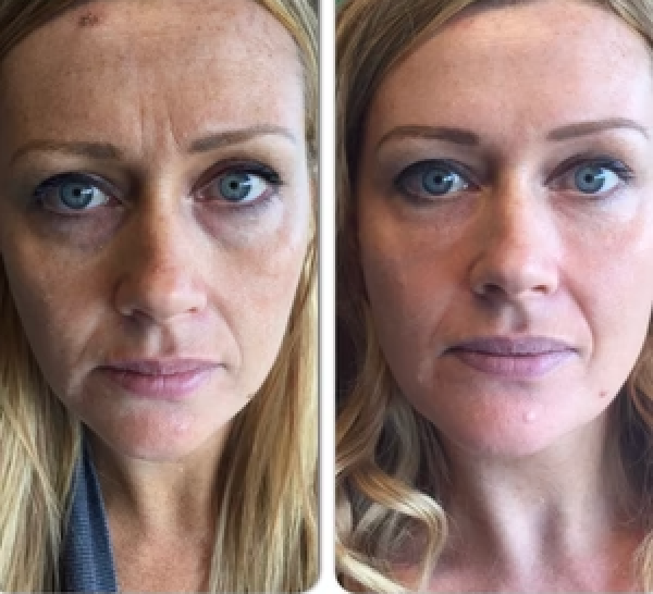 Review by Veronica S.