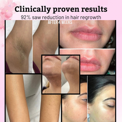 Naya Cyperus Rotundus Oil for Hair Removal